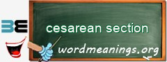 WordMeaning blackboard for cesarean section